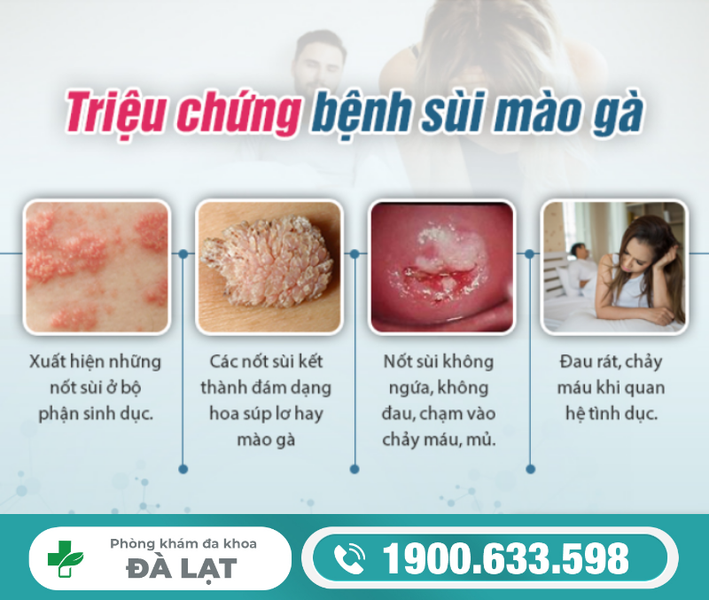 Hình ảnh minh họa